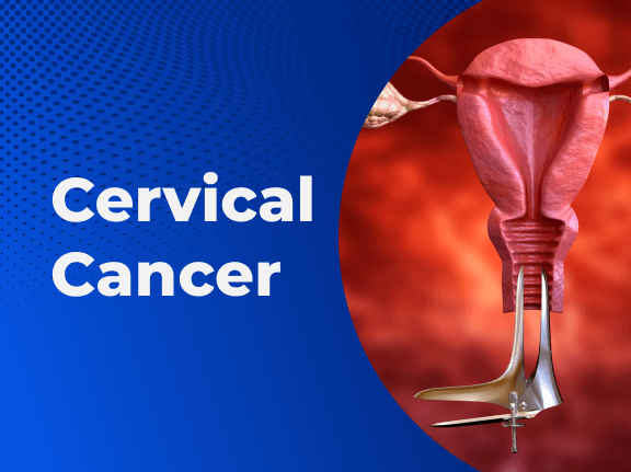 (Cervical Cancer)