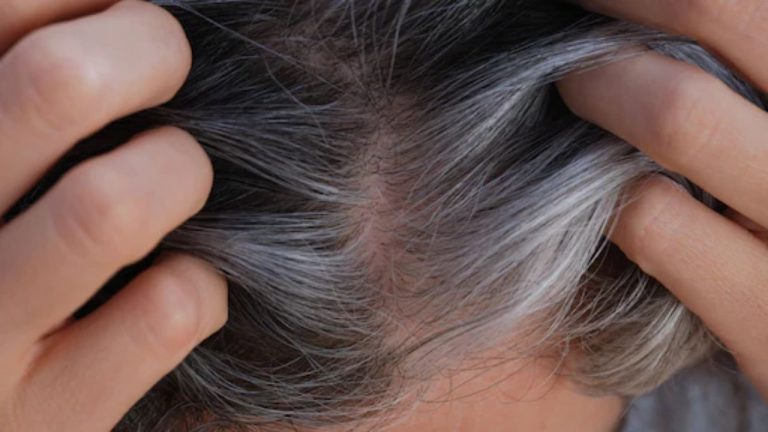 White Hair Remedies