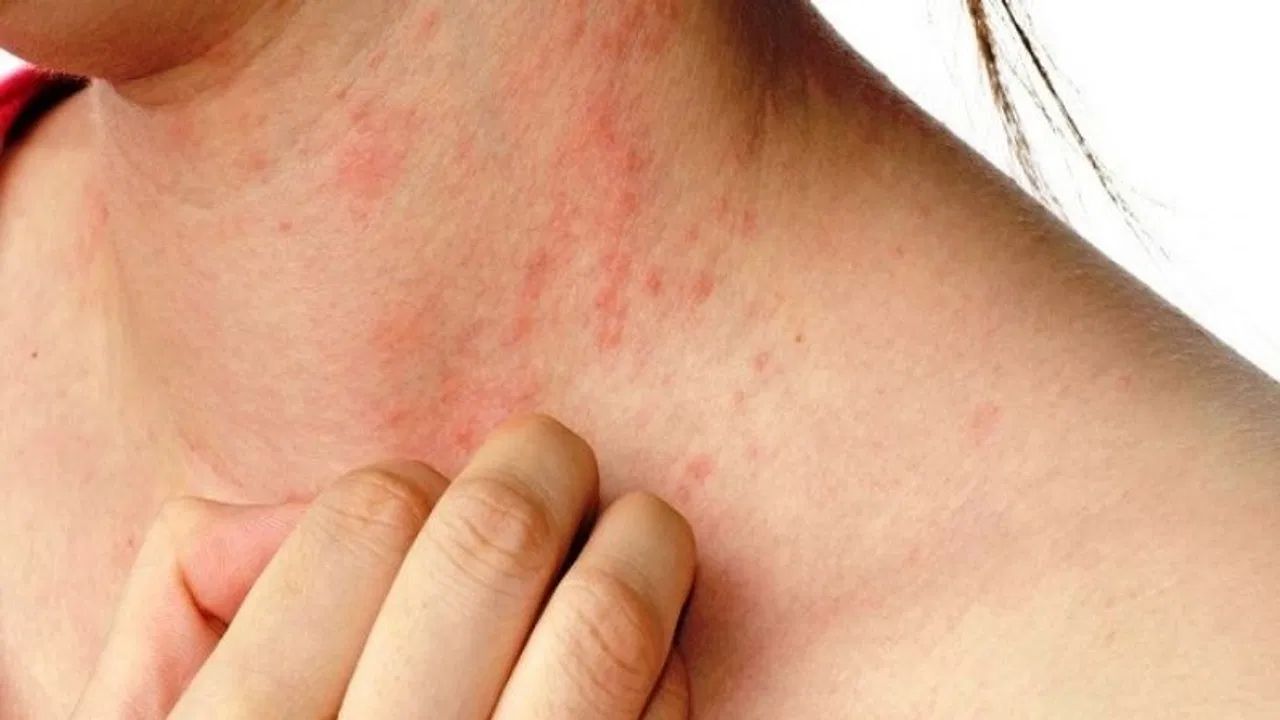 Ghamoriya Removing Tips