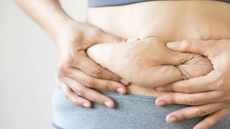 Post Delivery Diet Tips