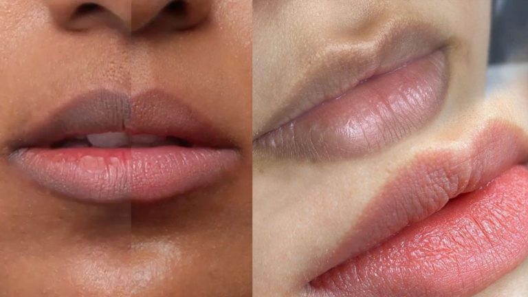 Lip Care Tips