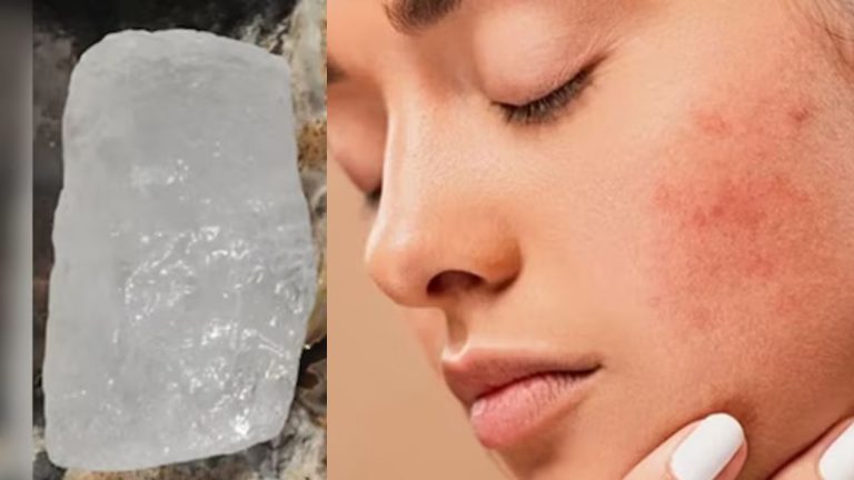 Alum and Gulab Jal For Face