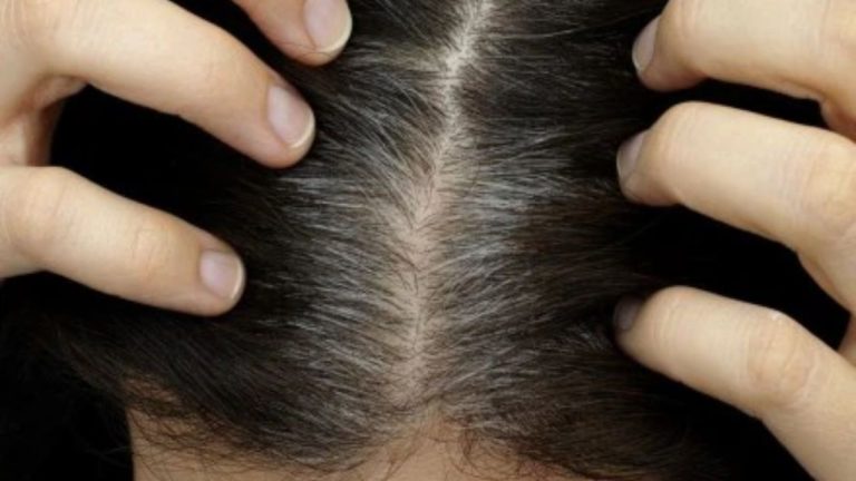 Tips For Gray Hair