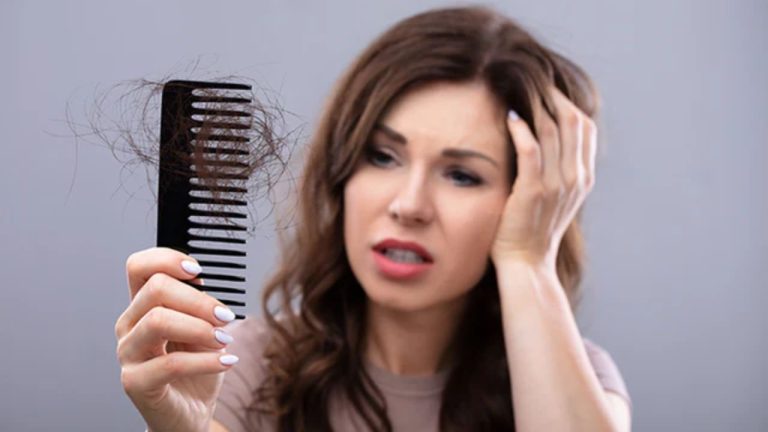 Hairfall Remedies
