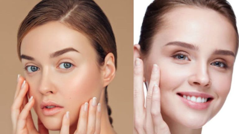 Skin Whitening Tips