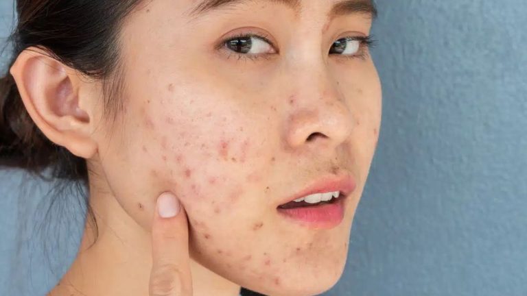 Skin Care Mistakes