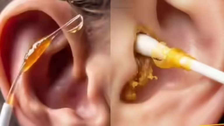 Tips To Remove Earwax