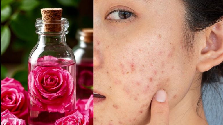 Gulaab Jal Benefits